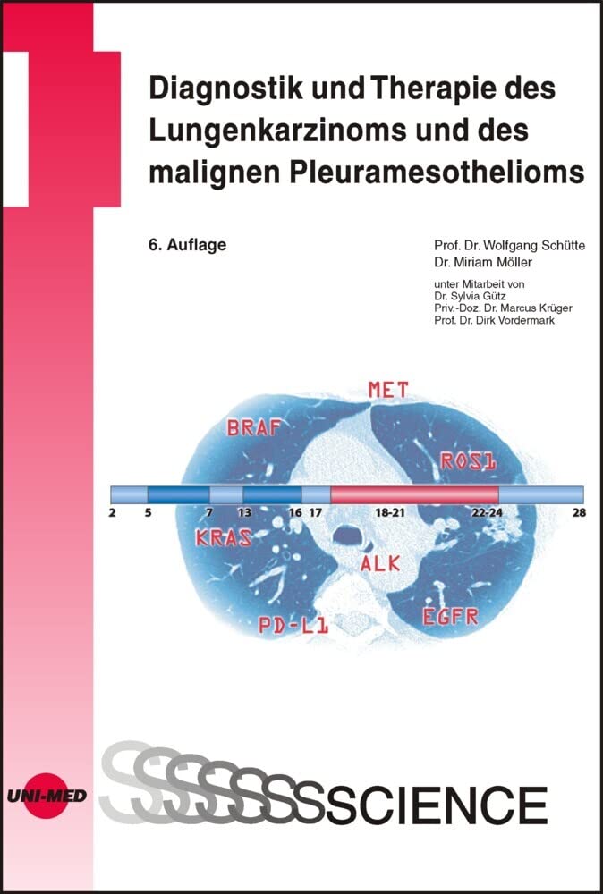 Diagnostik und Therapie des Lungenkarzinoms und des malignen Pleuramesothelioms (UNI-MED Science) Medicine