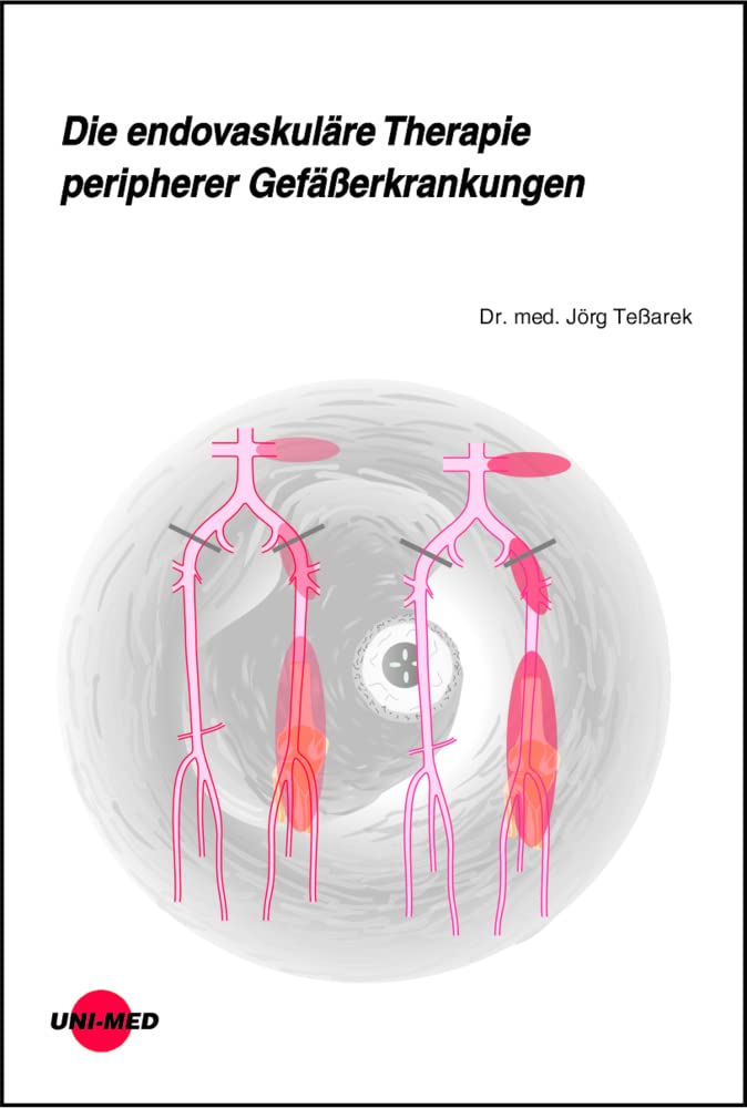 Die endovaskuläre Therapie peripherer Gefäßerkrankungen (UNI-MED Science) Medicine