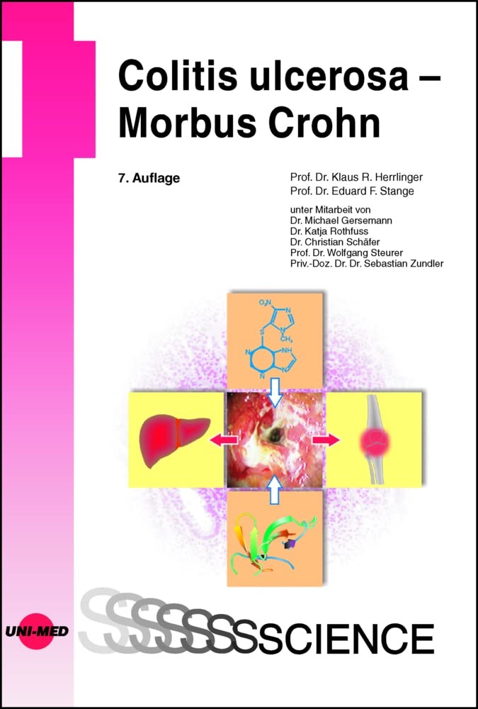 Colitis ulcerosa – Morbus Crohn (UNI-MED Science) Medicine