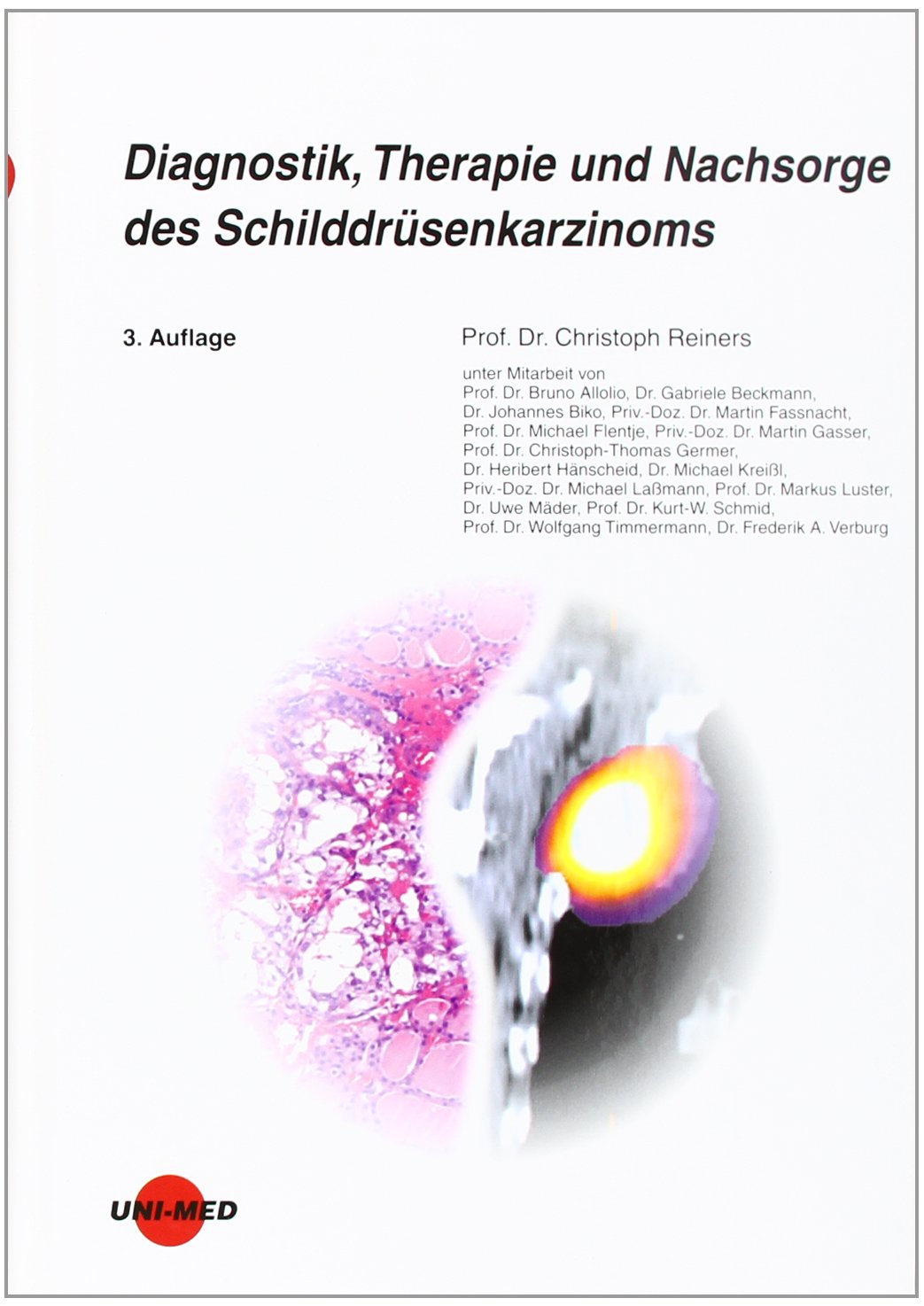 Diagnostik, Therapie und Nachsorge des Schilddrüsenkarzinoms Books