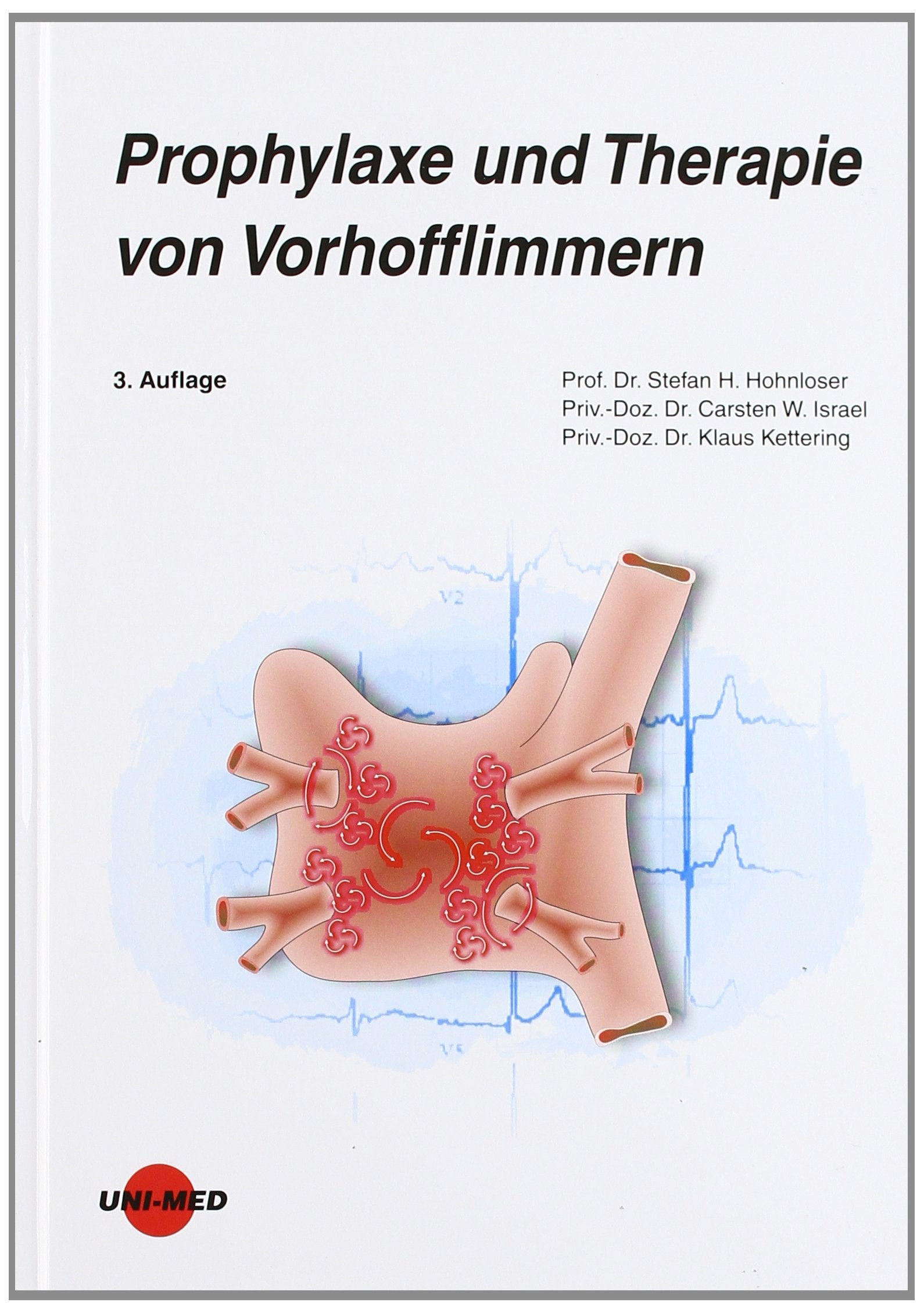 Prophylaxe und Therapie von Vorhofflimmern Medicine