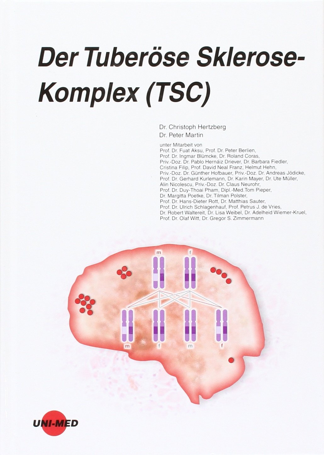 Der Tuberöse Sklerose-Komplex (TSC) Medicine