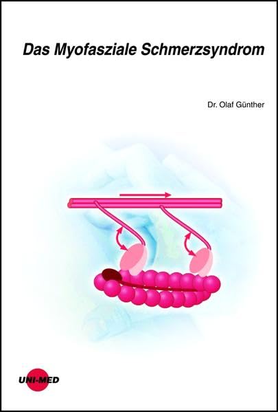 Das Myofasziale Schmerzsyndrom Medicine