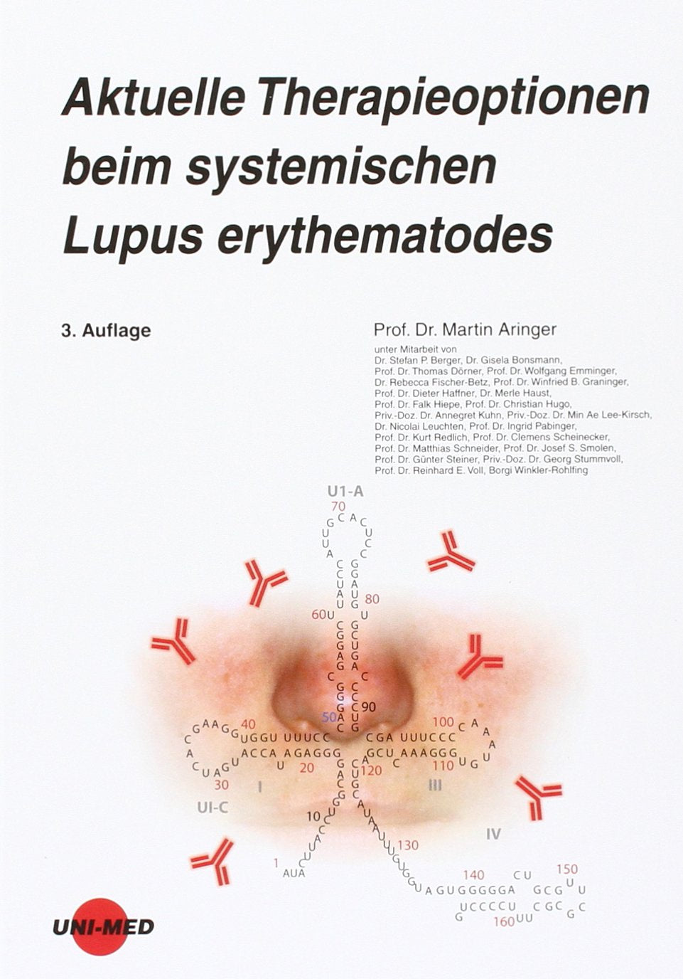 Aktuelle Therapieoptionen beim systemischen Lupus erythematodes Medicine