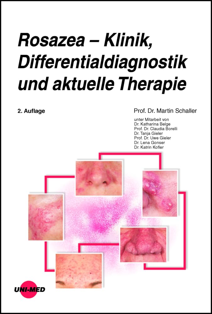 Rosazea – Klinik, Differentialdiagnostik und aktuelle Therapie (UNI-MED Science) Medicine