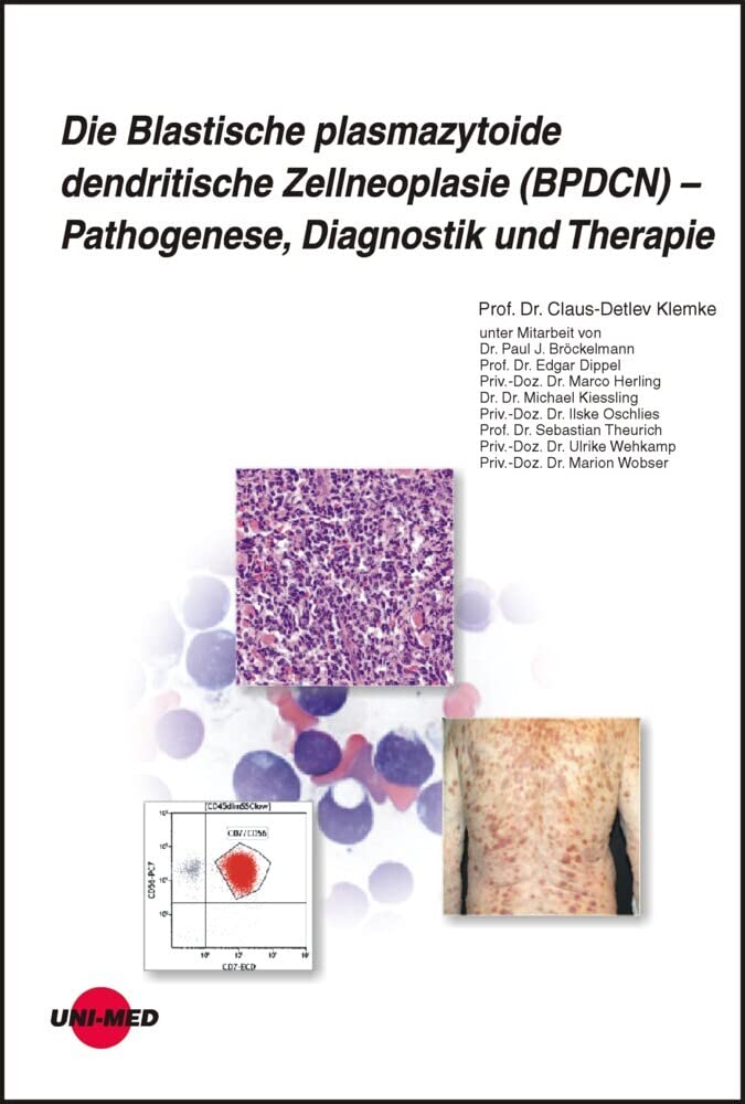 Die Blastische plasmazytoide dendritische Zellneoplasie (BPDCN) - Pathogenese, Diagnostik und Therapie Medicine