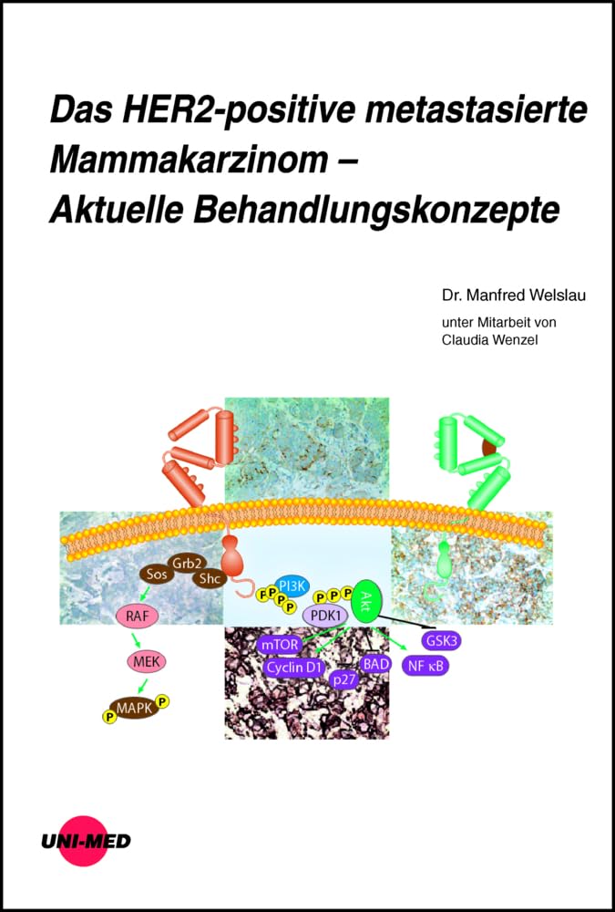 Das HER2-positive metastasierte Mammakarzinom – Aktuelle Behandlungskonzepte (UNI-MED Science) Medicine