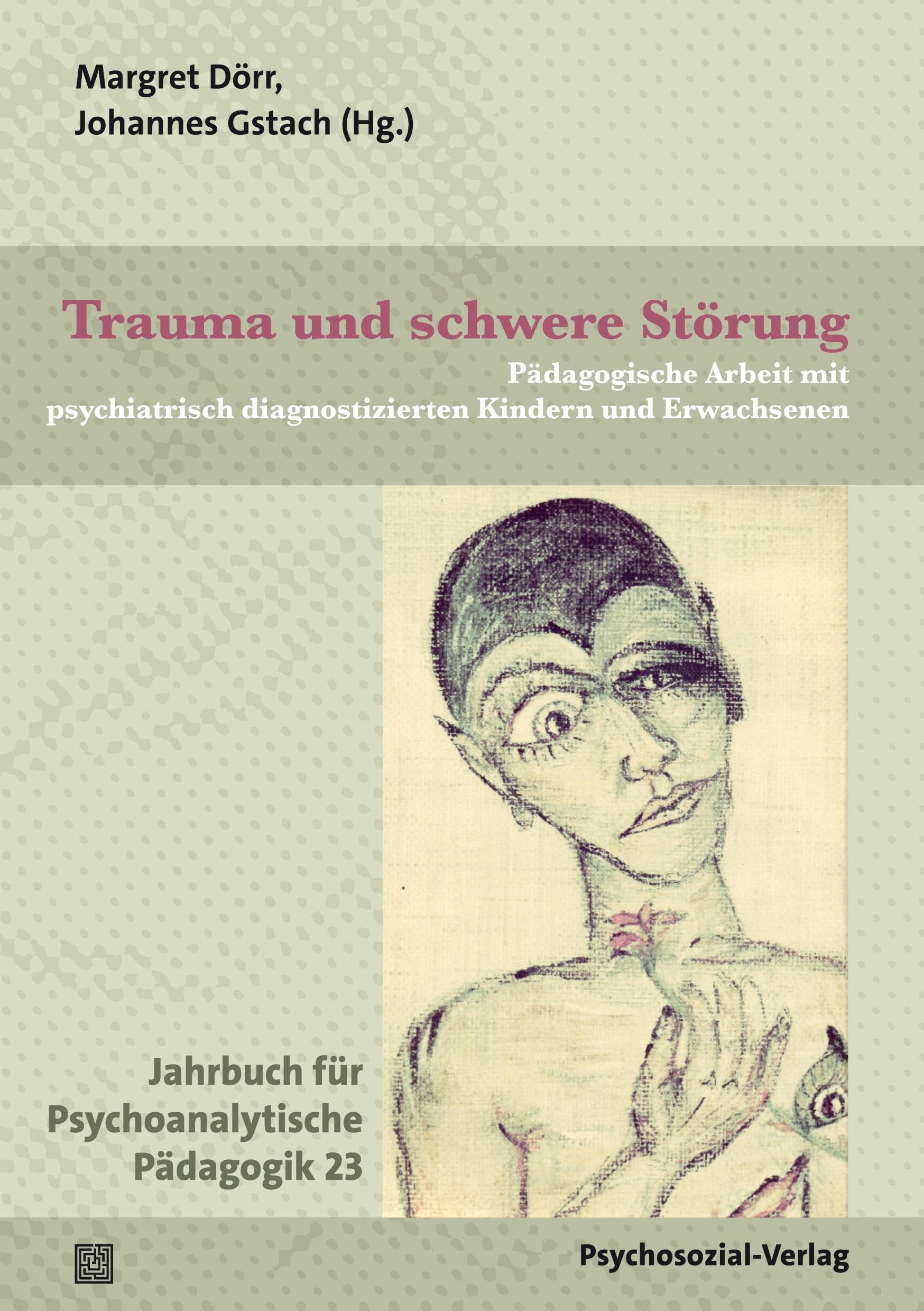 Trauma und schwere Störung Medicine