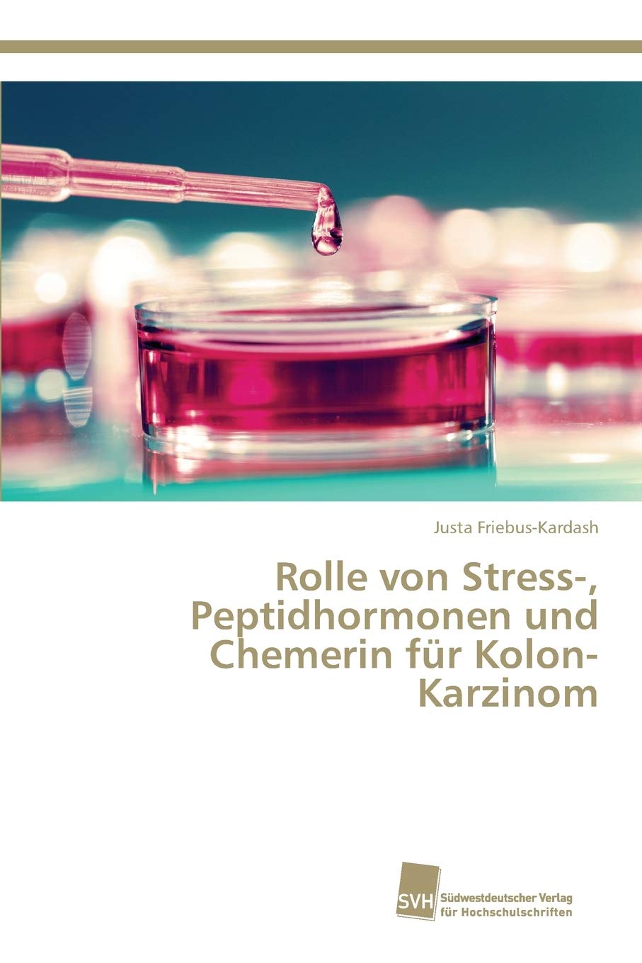 Rolle von Stress-, Peptidhormonen und Chemerin für Kolon-Karzinom Medicine