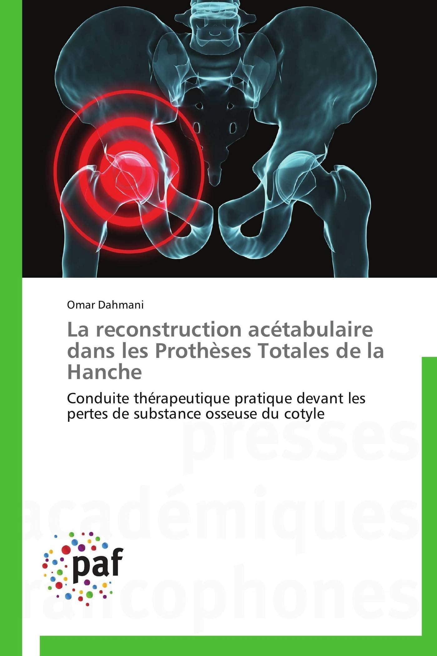 La reconstruction acétabulaire dans les prothèses totales de la hanche book