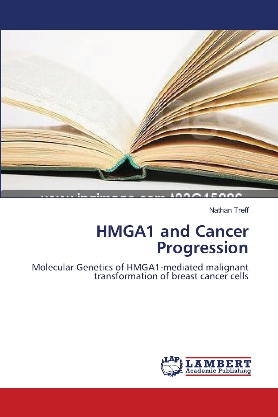 HMGA1 and Cancer Progression: Molecular Genetics of HMGA1-mediated malignant transformation of breast cancer cells Natural Sciences