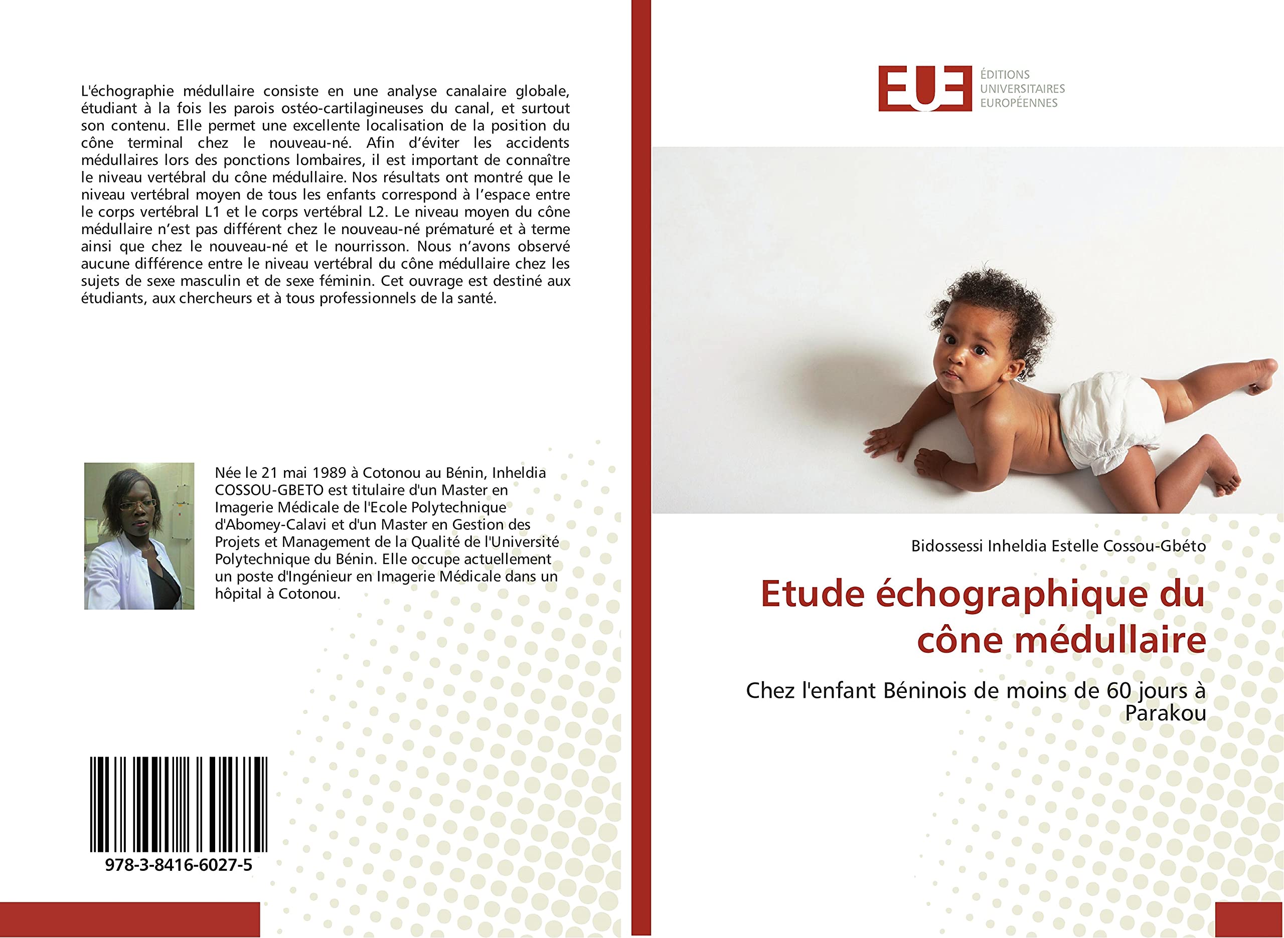 Etude échographique du cône médullaire: Chez l'enfant Béninois de moins de 60 jours à Parakou book