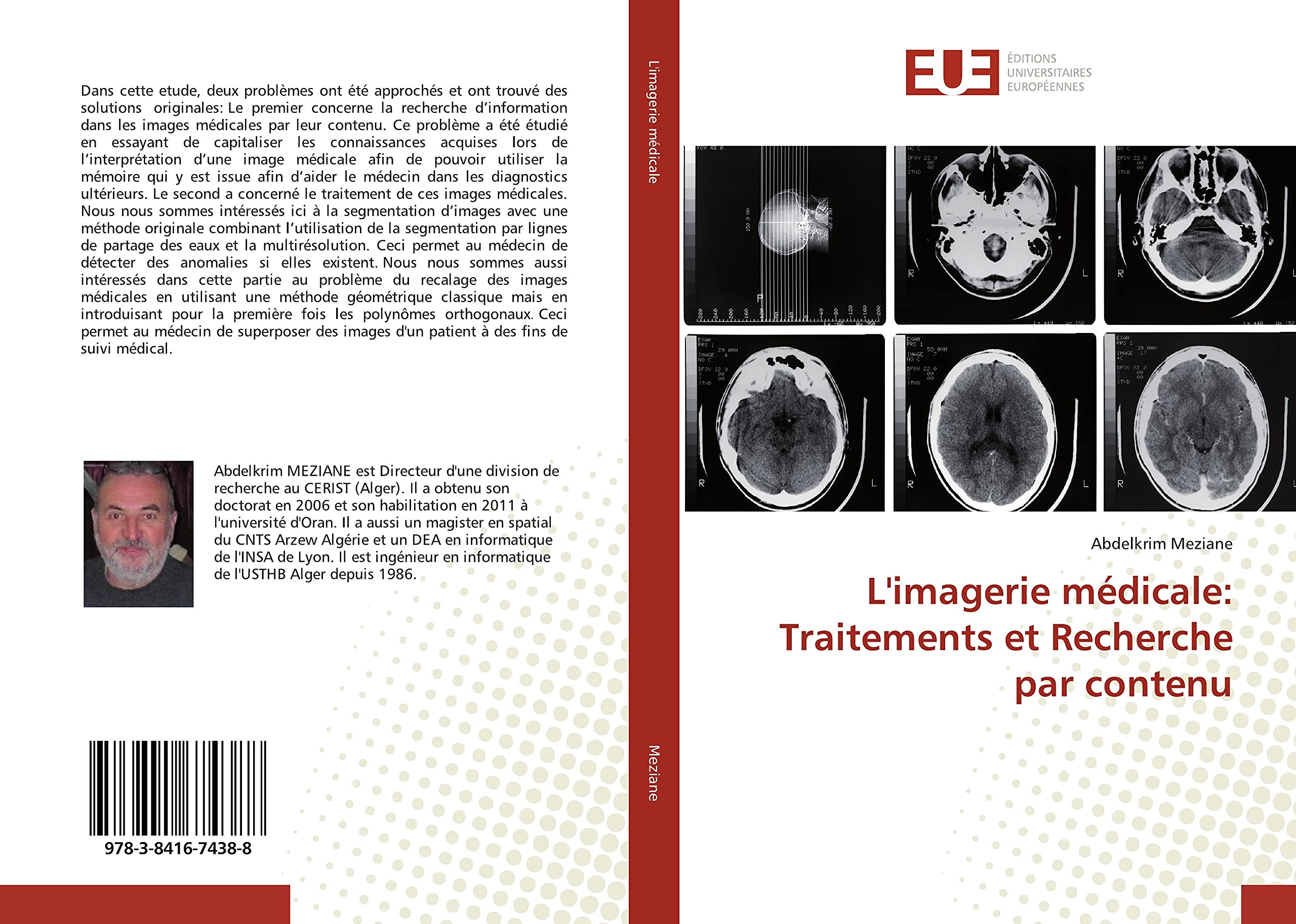 L'imagerie médicale: Traitements et Recherche par contenu book