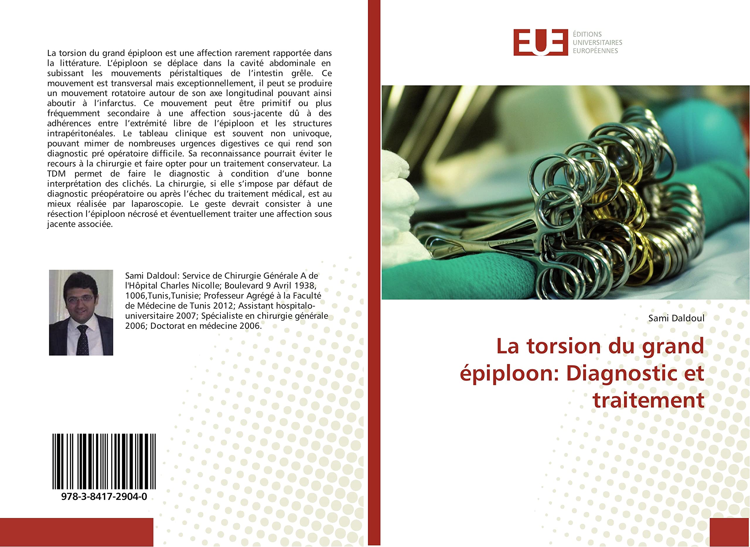 La torsion du grand epiploon: Diagnostic et traitement book