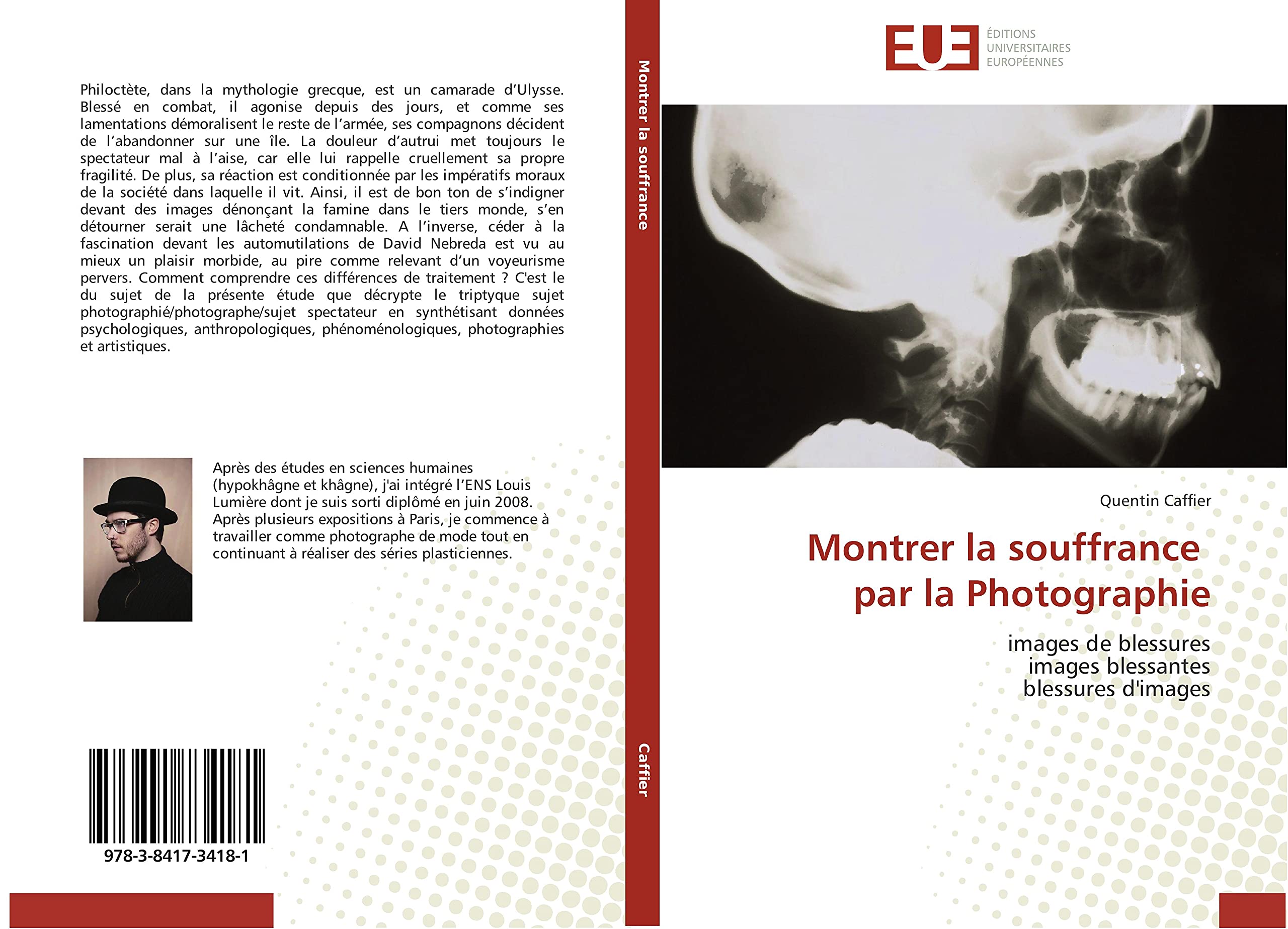 Montrer la souffrance par la Photographie: images de blessures images blessantes blessures d'images book