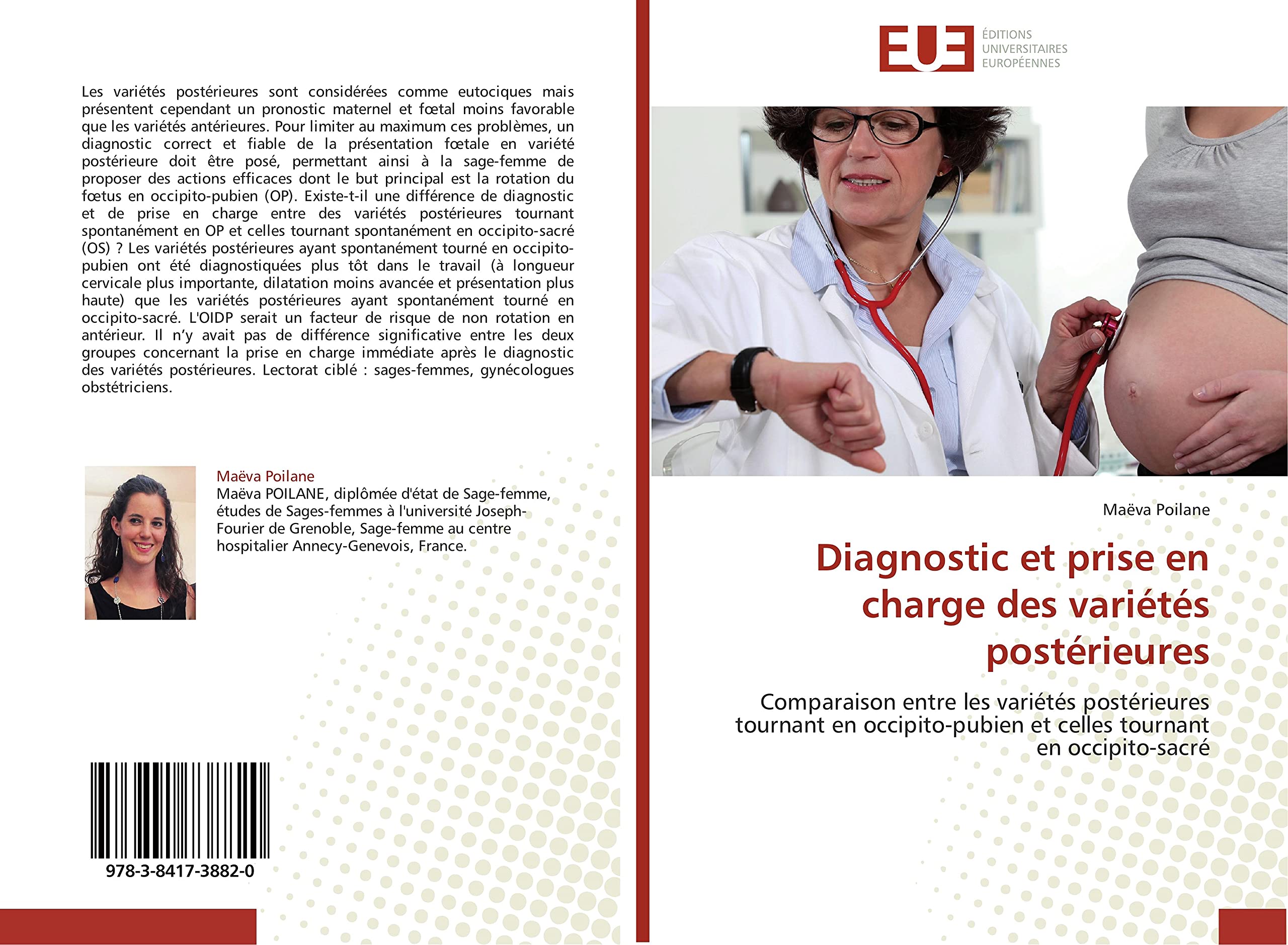Diagnostic et prise en charge des variétés postérieures: Comparaison entre les variétés postérieures tournant en occipito-pubien et celles tournant en occipito-sacré book