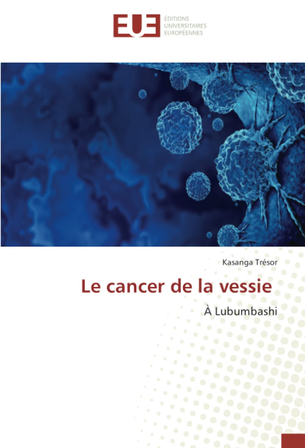 Le cancer de la vessie: À Lubumbashi book