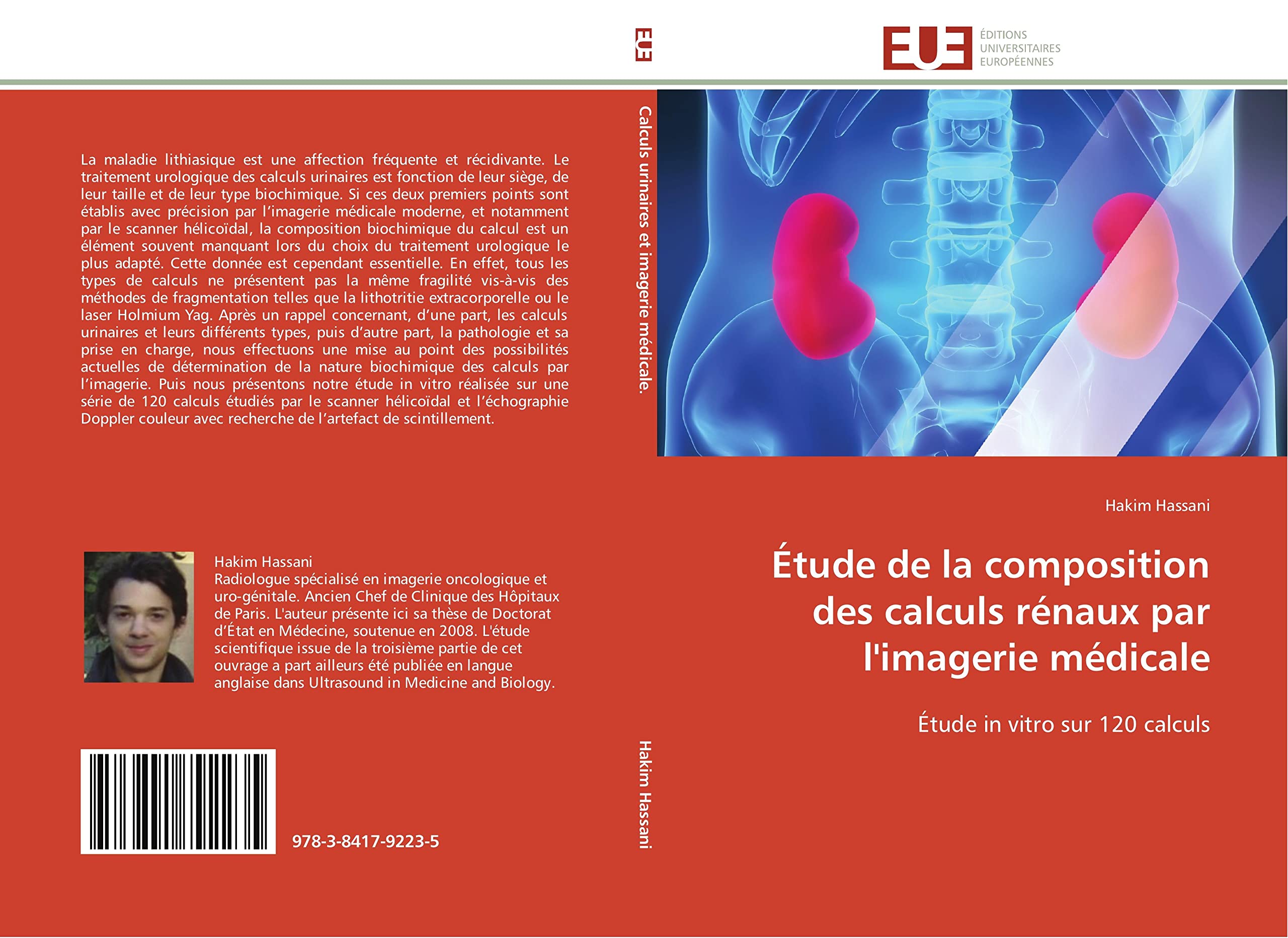 Étude de la composition des calculs rénaux par l'imagerie médicale: Étude in vitro sur 120 calculs book