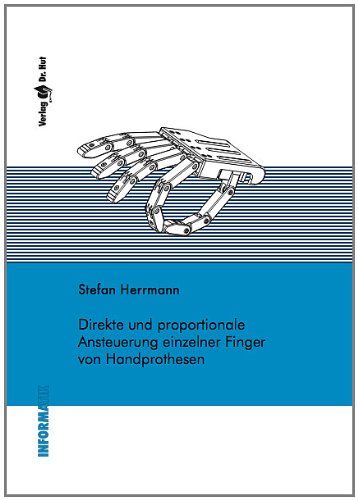 Direkte und proportionale Ansteuerung einzelner Finger von Handprothesen (Informatik) Computer Science