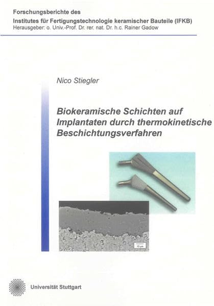 Biokeramische Schichten auf Implantaten durch thermokinetische Beschichtungsverfahren: Thermisches Spritzen von Biomaterialien (Forschungsberichte des ... Fertigungstechnologie keramischer Bauteile) Business & Technology