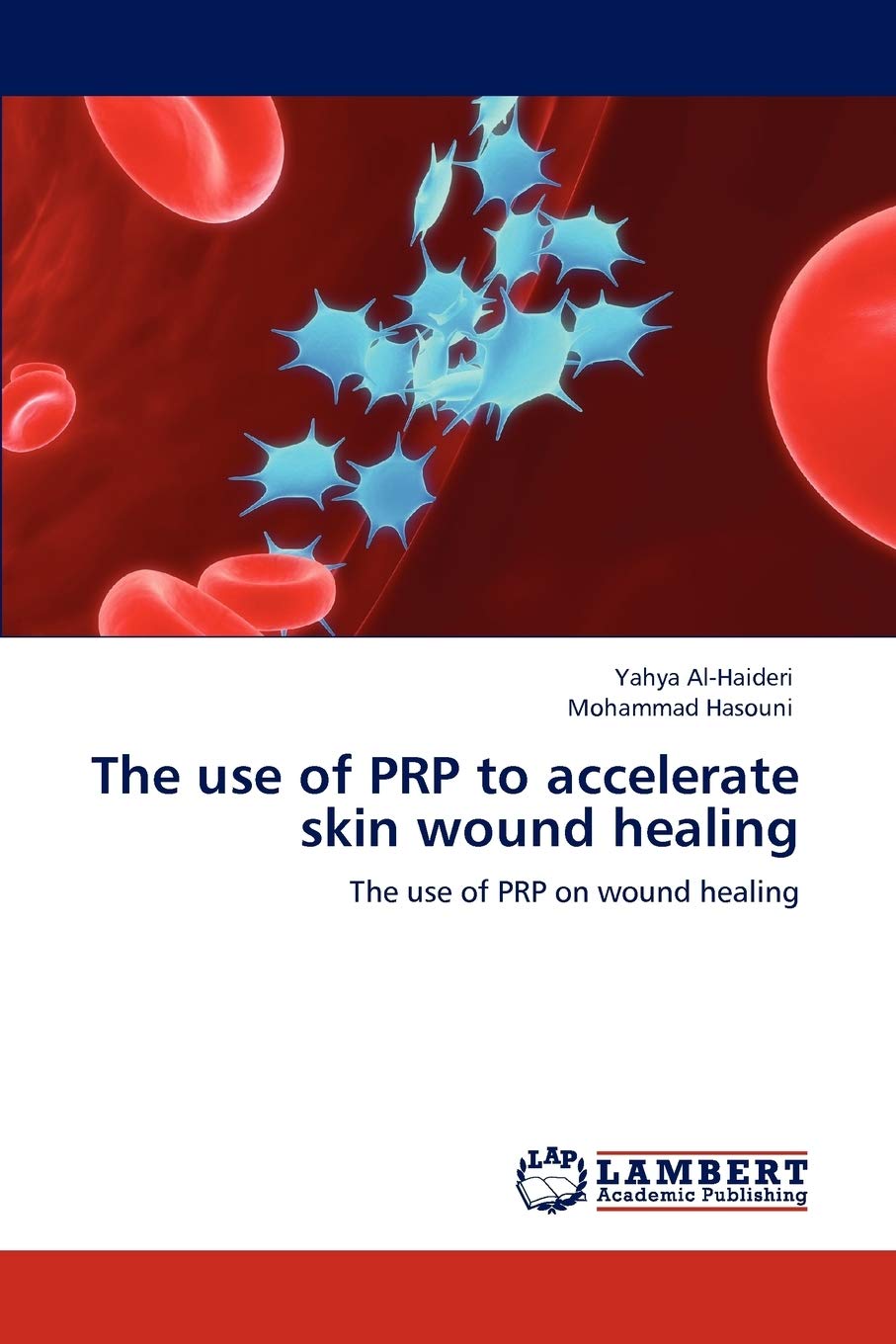 The use of PRP to accelerate skin wound healing Medicine