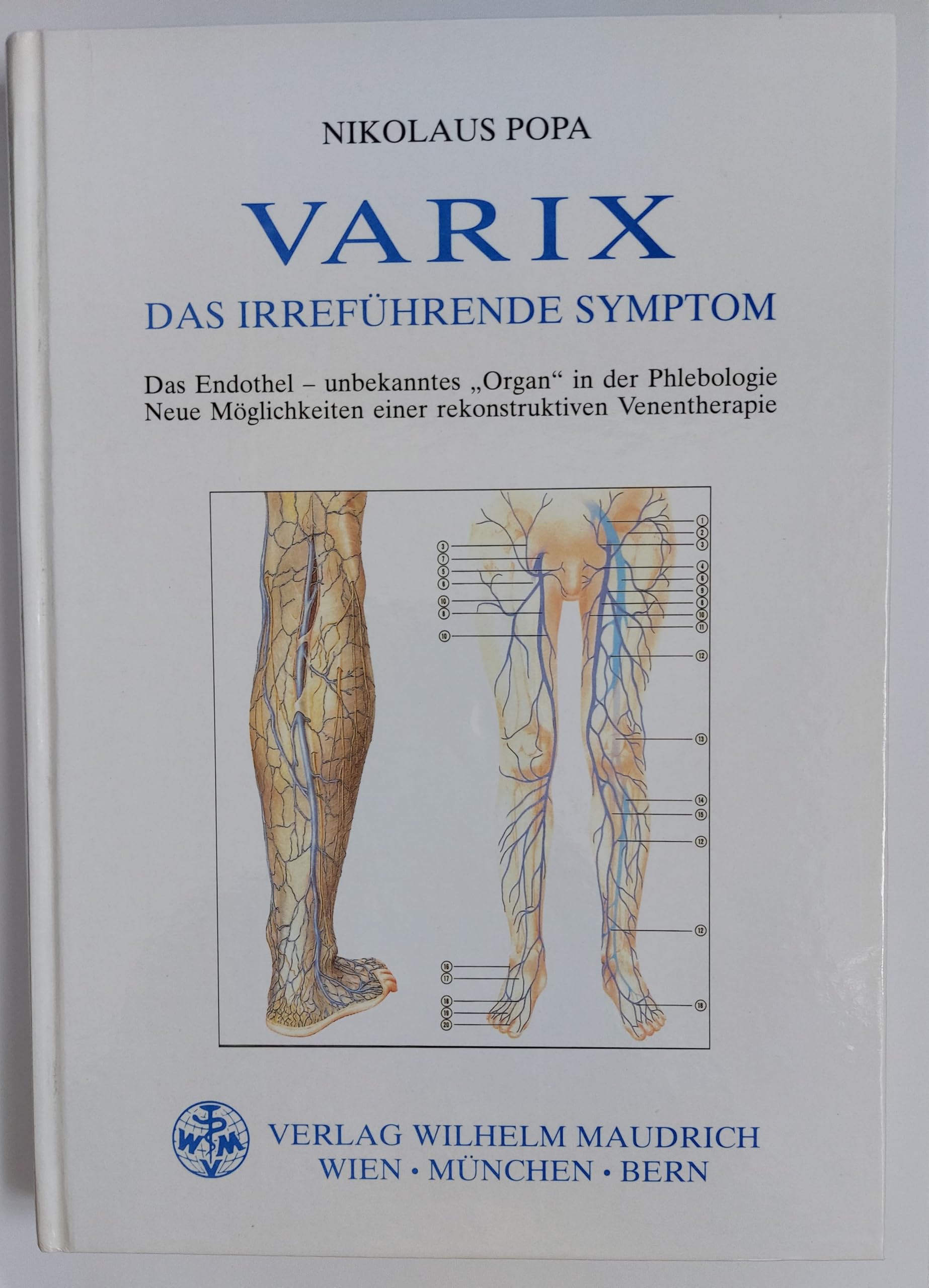 VARIX - Das Irreführende Symptom: Neue Möglichkeiten einer rekonstruktiven Venentherapie Medicine