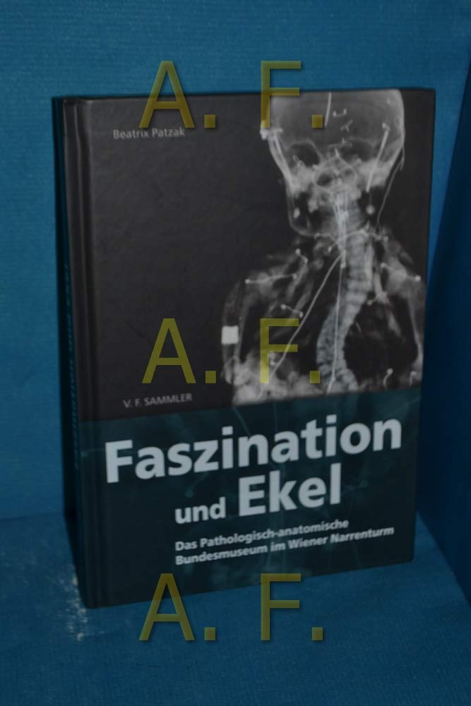 Faszination und Ekel: Das Pathologisch-anatomische Bundesmuseum im Wiener Narrenturm Medicine