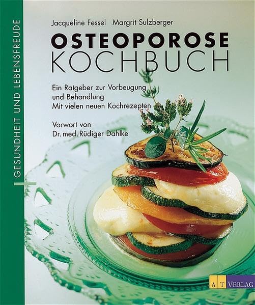 Osteoporose- Kochbuch. Ein Ratgeber zur Vorbeugung und Behandlung: Ein Ratgeber zur ganzheitlichen Behandlung - mit vielen neuen Kochrezepten (Essen und Trinken) Books