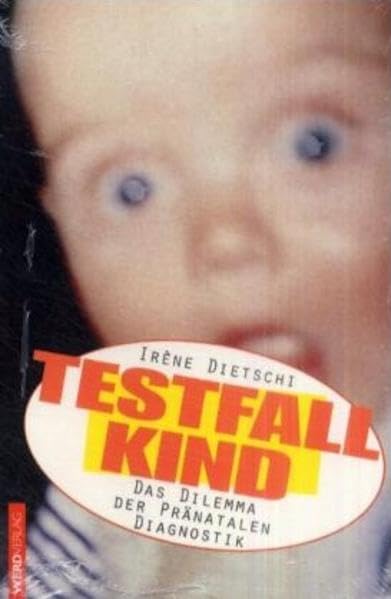 Testfall Kind: Fluch und Segen der pränatalen Diagnostik Medicine