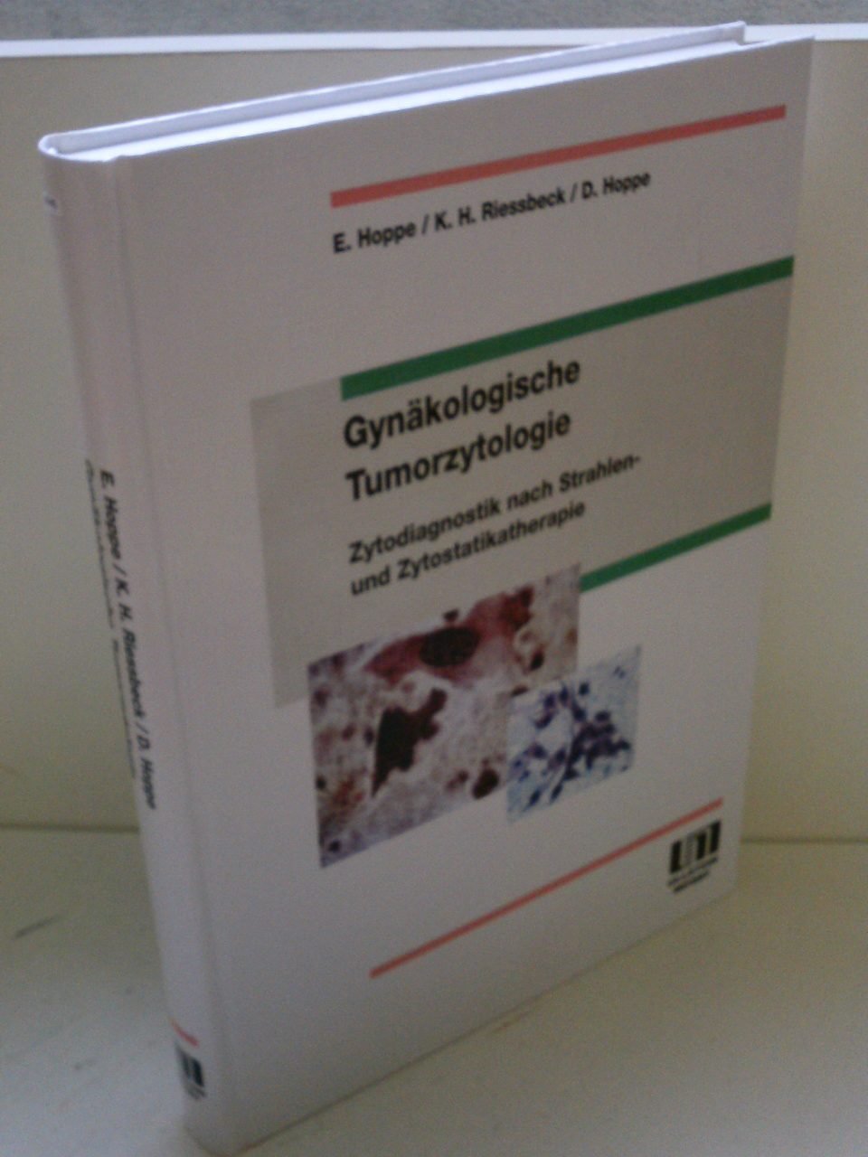 Gynäkologische Tumorzytologie Medicine
