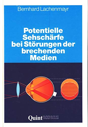 Potentielle Sehschärfe bei Störungen der brechenden Medien. Prüfung der sogenannten retinalen Sehschärfe Film, Art & Culture