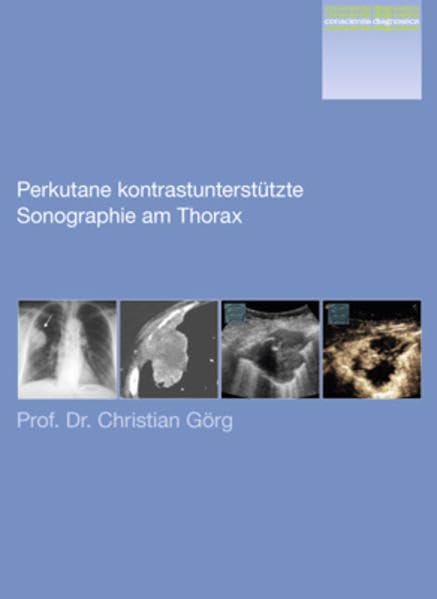 Conscientia Diagnostica: Perkutane kontrastunterstützte Sonographie am Thorax Medicine