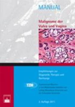 Malignome der Vulva und Vagina Medicine