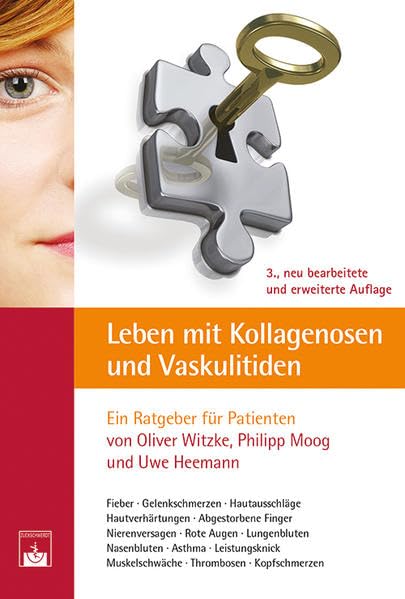 Leben mit Kollagenosen und Vaskulitiden Health, Nutrition & Fitness