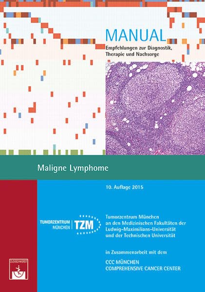 Product Image: Maligne Lymphome