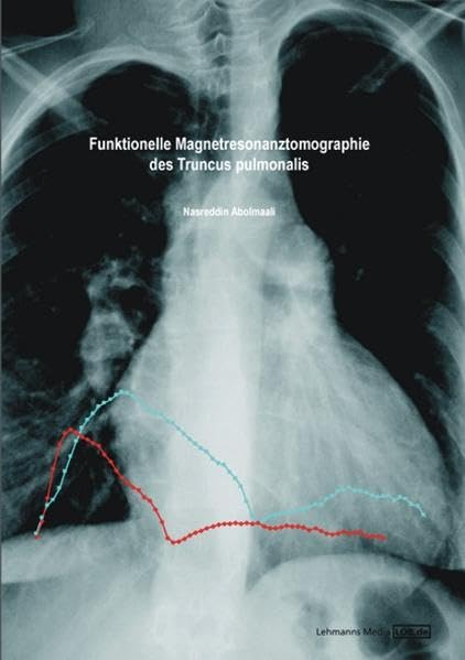 Funktionelle Magnetresonanztomographie des Truncus pulmonalis Medicine