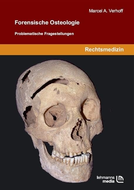 Forensische Osteologie Medicine