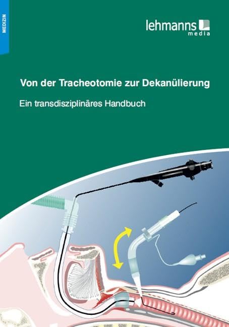 Von der Tracheotomie zur Dekanülierung Medicine