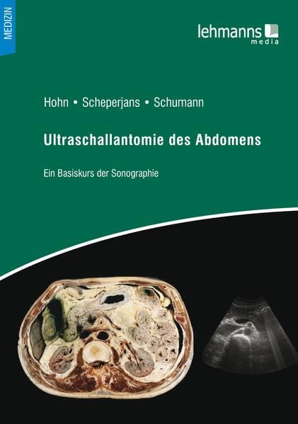 Ultraschallanatomie des Abdomens: Ein Basiskurs der Sonografie Medicine
