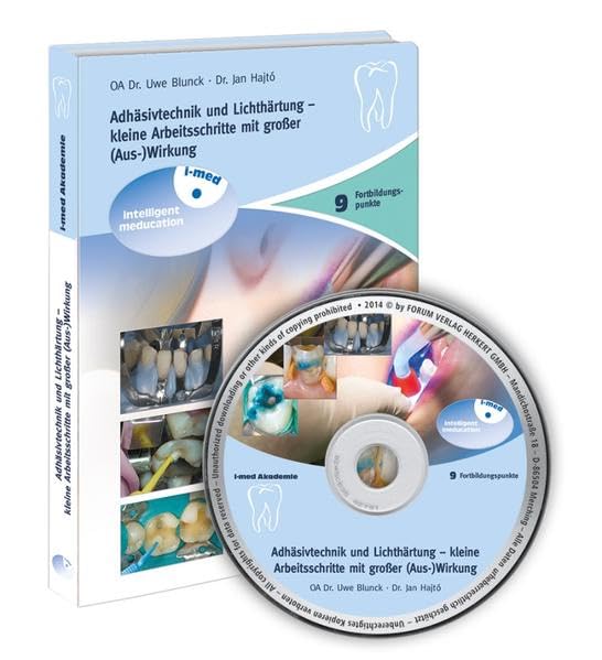 Adhäsivtechnik und Lichthärtung - kleine Arbeitsschritte mit großer (Aus-)Wirkung, DVD Films