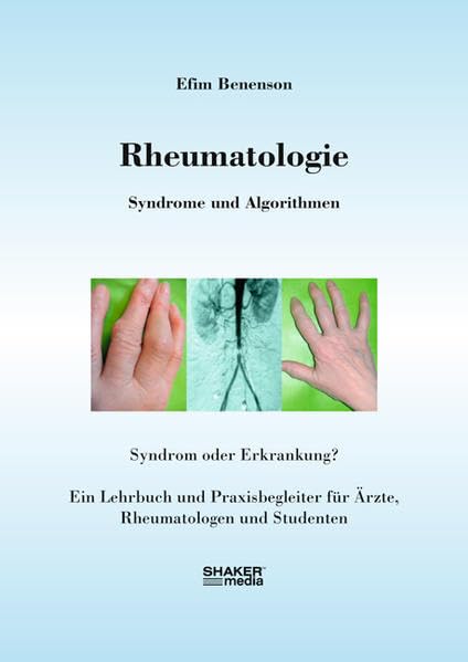 Rheumatologie - Syndrome und Algorithmen: Ein Lehrbuch und Praxisbegleiter für Ärzte, Rheumatologen und Studenten Health, Nutrition & Fitness