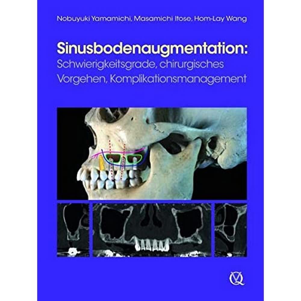 Product Image: Sinusbodenaugmentation