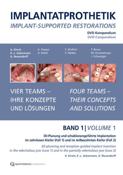 Implantatprothetik. DVD, Band 1 Films