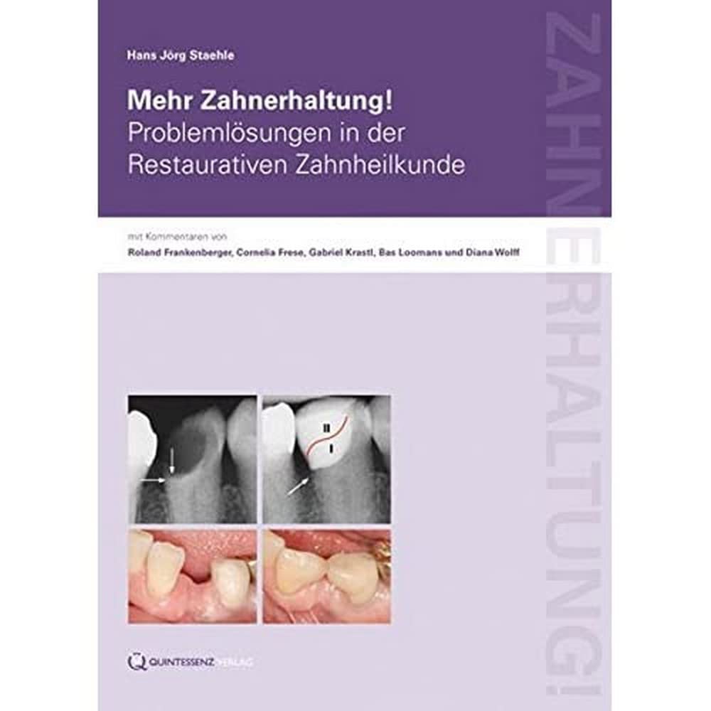 Mehr Zahnerhaltung!: Problemlösungen in der Restaurativen Zahnheilkunde Medicine