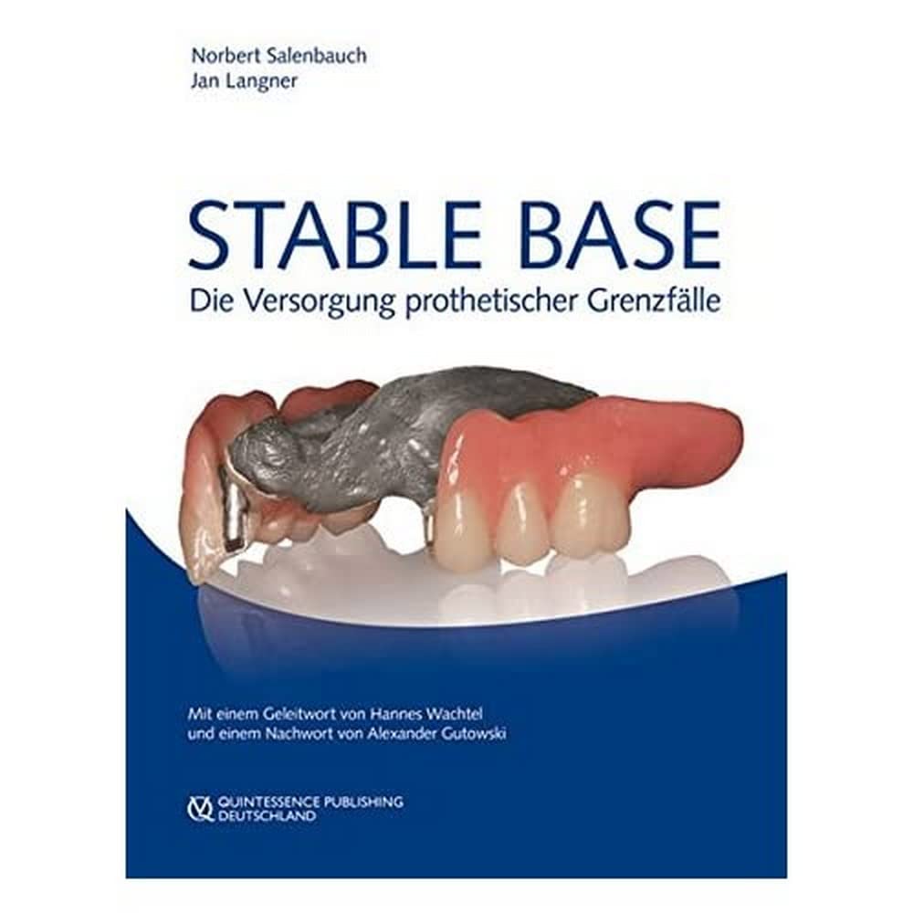 Stable Base: Die Versorgung prothetischer Grenzfälle Medicine