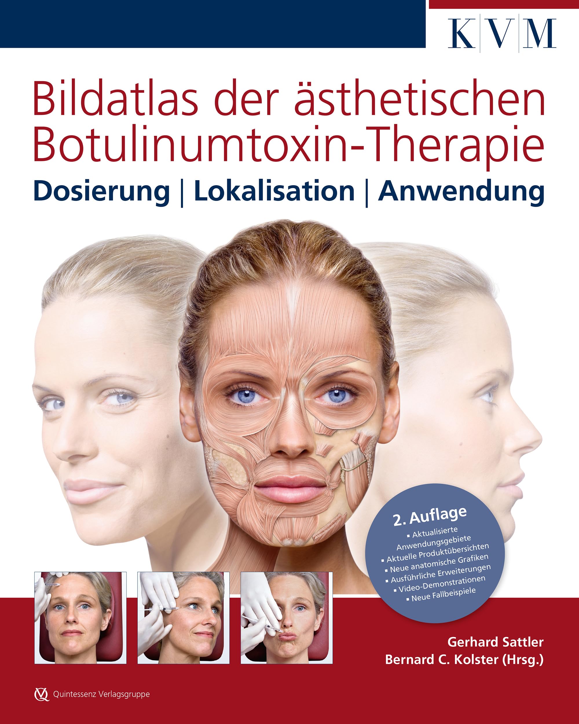 Bildatlas der ästhetischen Botulinumtoxin-Therapie Medicine