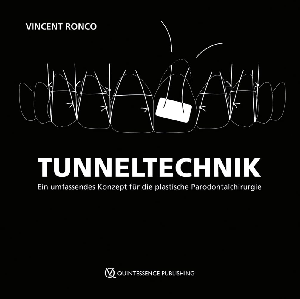 Tunneltechnik: Ein umfassendes Konzept für die plastische Parodontalchirurgie Medicine