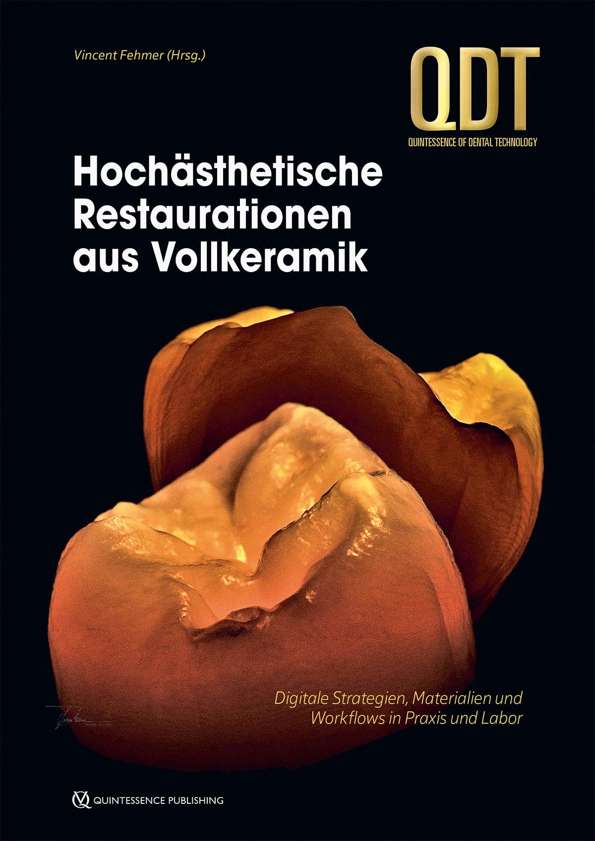 Hochästhetische Restaurationen aus Vollkeramik Medicine