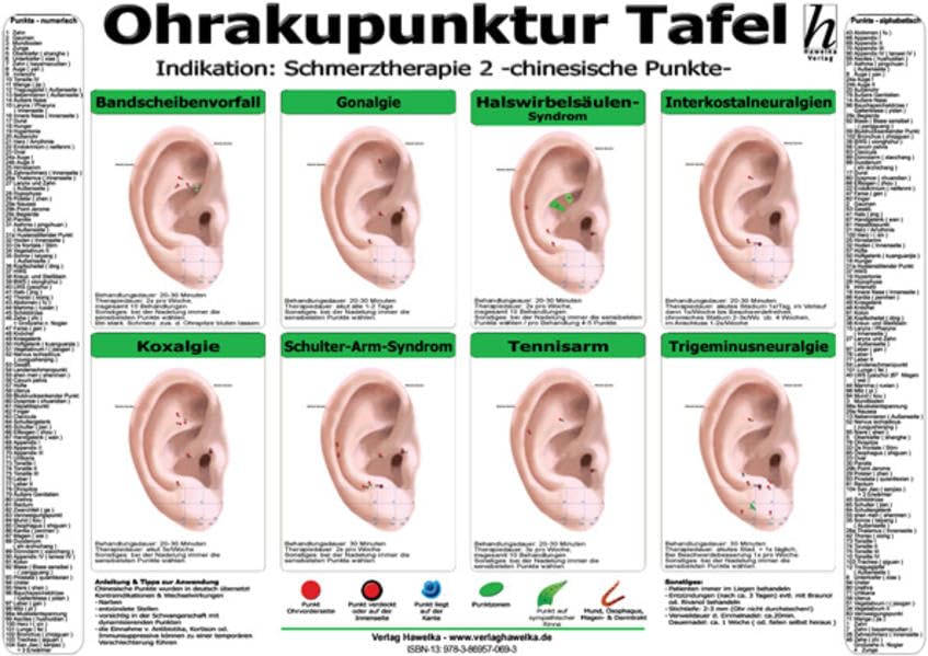 Ohrakupunktur Tafel - Indikation: Schmerztherapie 2 Medicine