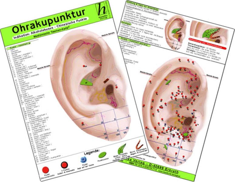 Ohrakupunktur - Indikation: Schwindel & Morbus Menière - chinesische Ohrakupunktur / Medizinische Taschen-Karte Medicine